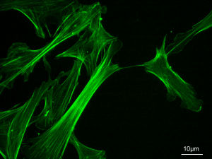 Actina del citoscheletro di fibroblasti embrionali di Mus musculus colorata con falloidina